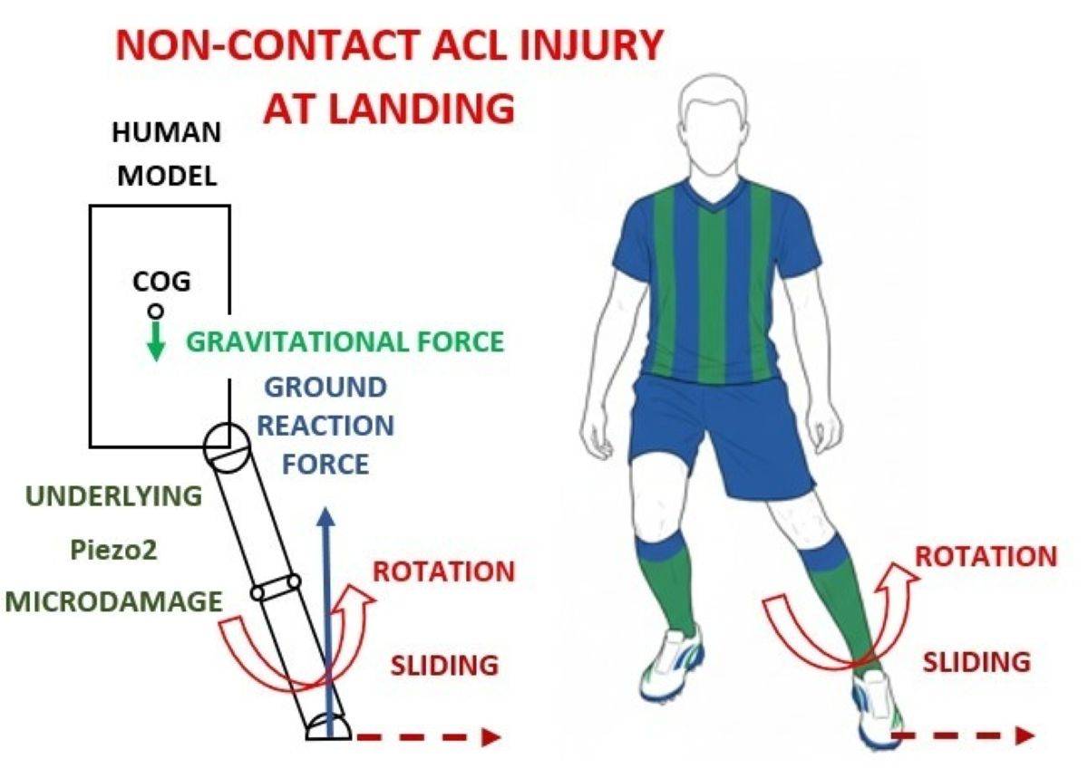 ACL terdserules 2